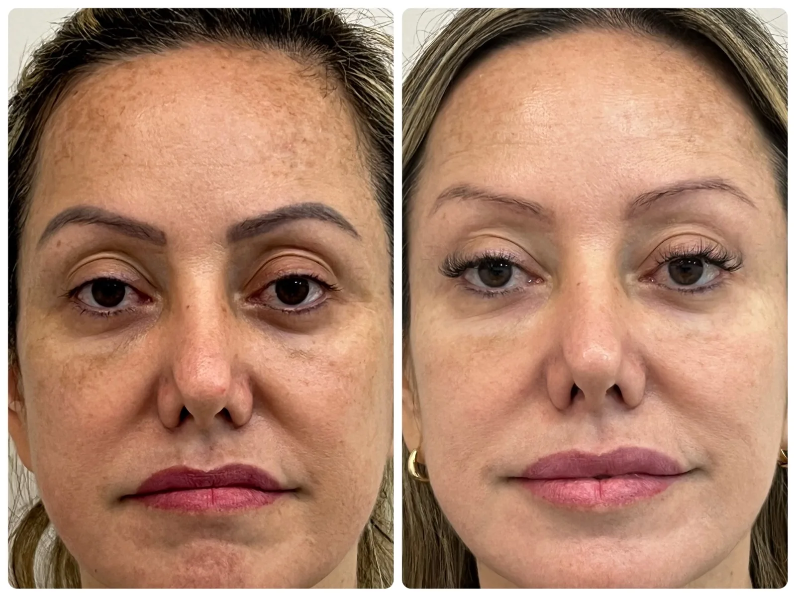 Antes e depois de quem seguiu o passo a passo