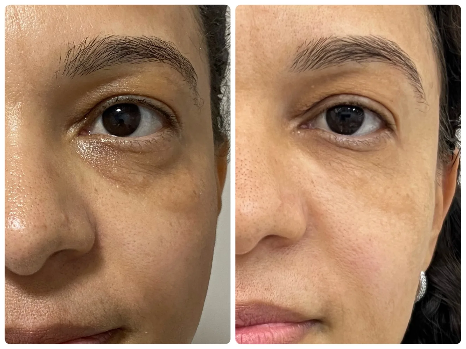 Antes e depois de quem seguiu o passo a passo