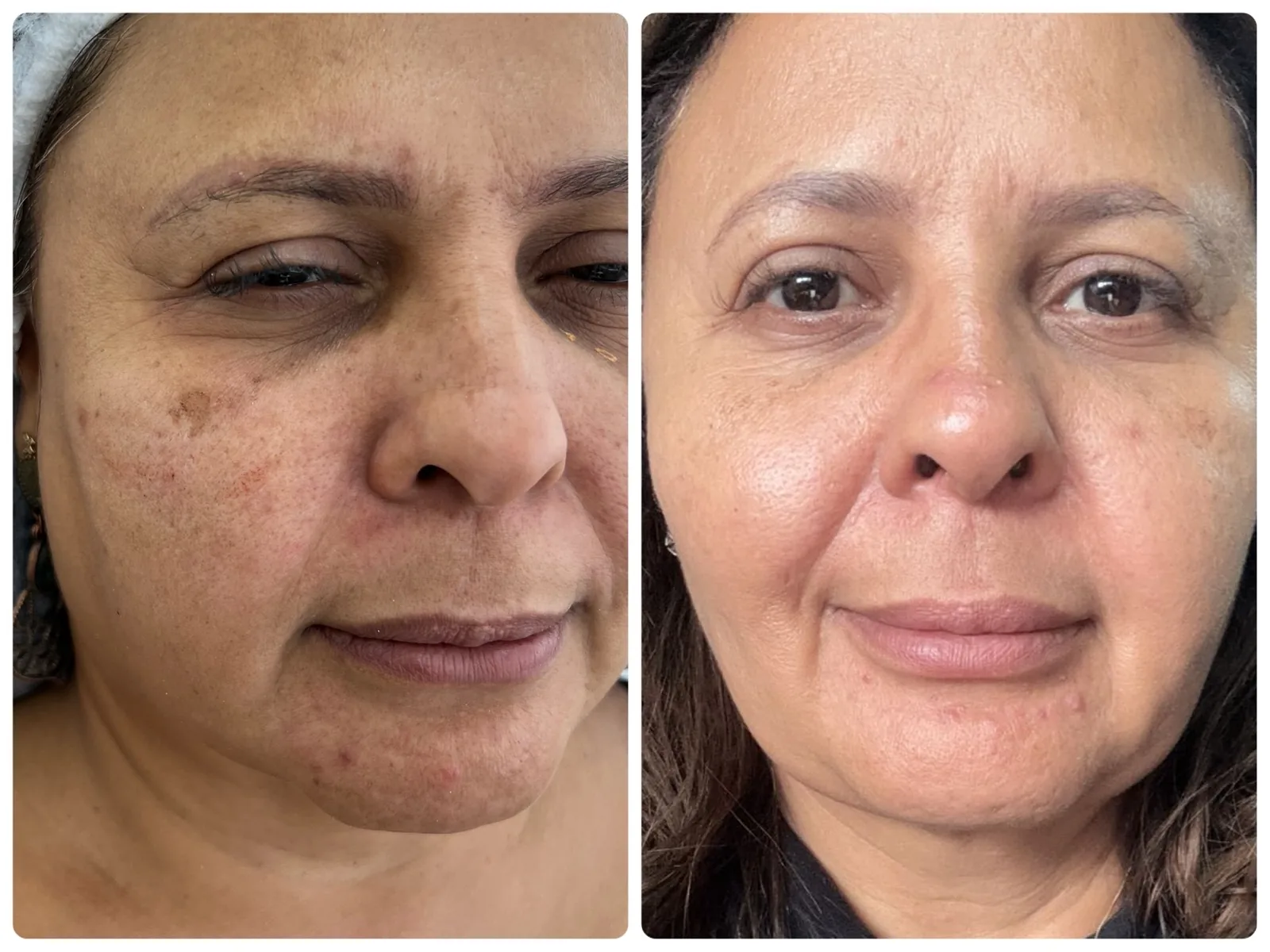 Antes e depois de quem seguiu o passo a passo